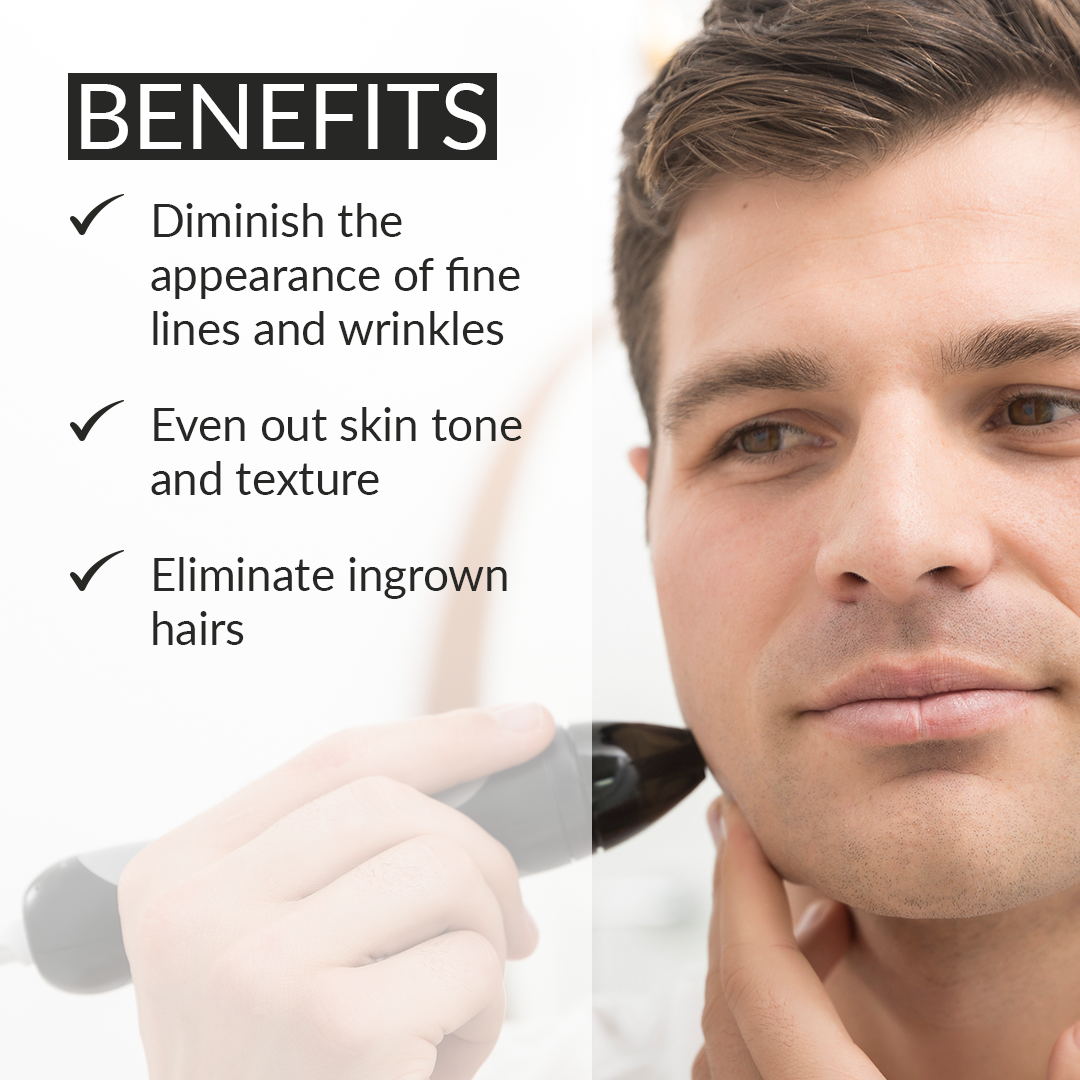 Personal Microderm Pro - Black