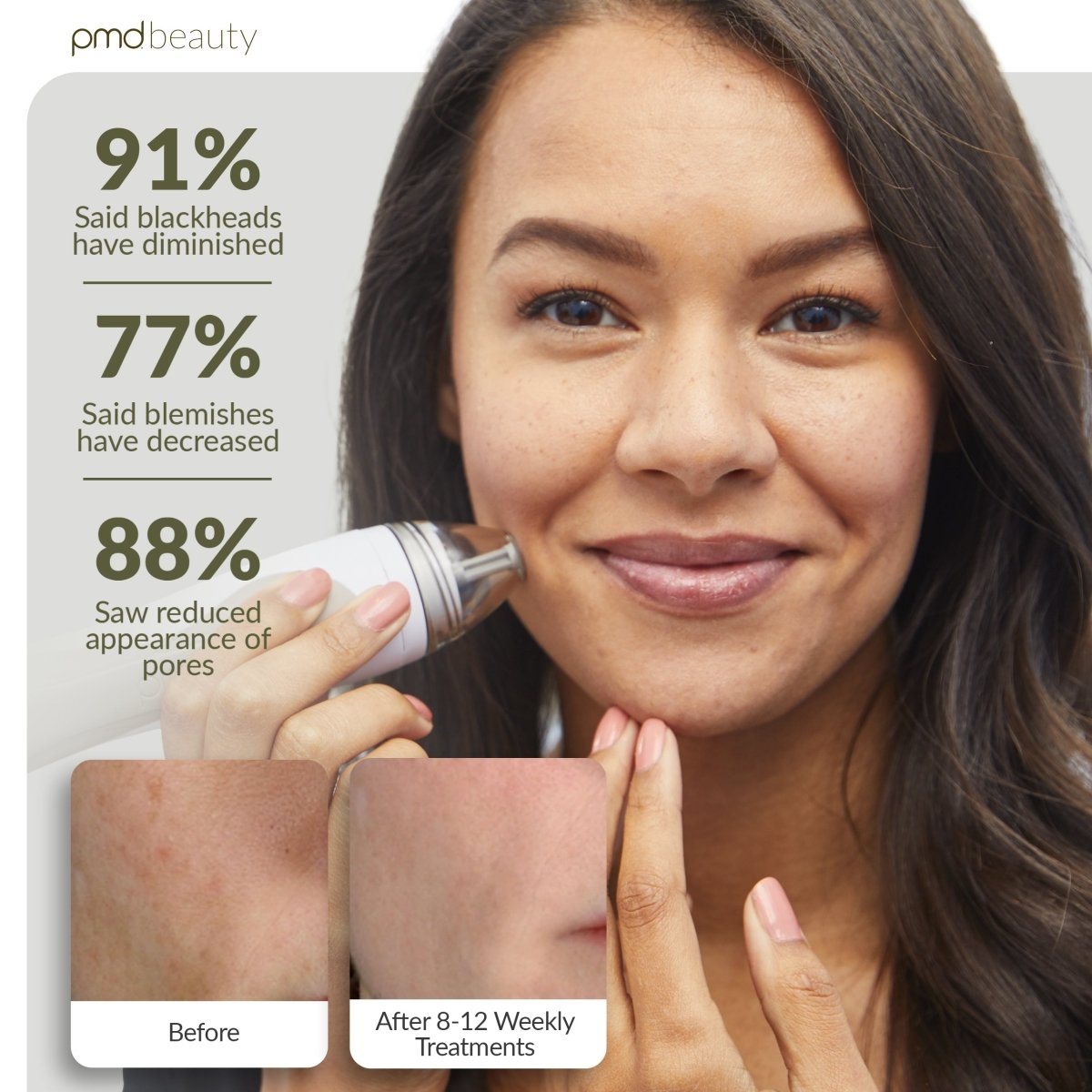 Personal Microderm Pro - International